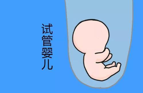 专家